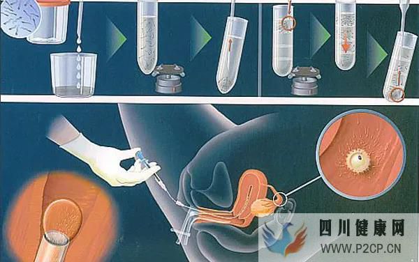 试管真的可以解决怀孕困难吗？？试管五点误区快看~(图1)