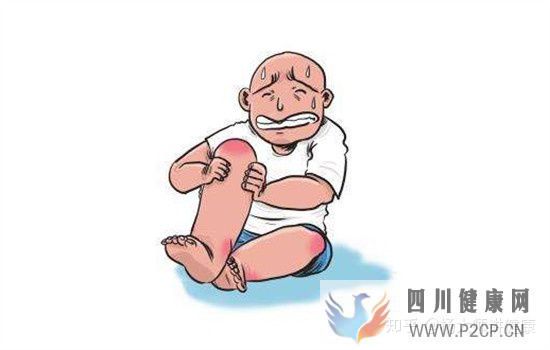 风湿病的早期症状有哪些7大症状要注意(图6) 风湿病的早期症状有哪些7大症状要注意(图6)