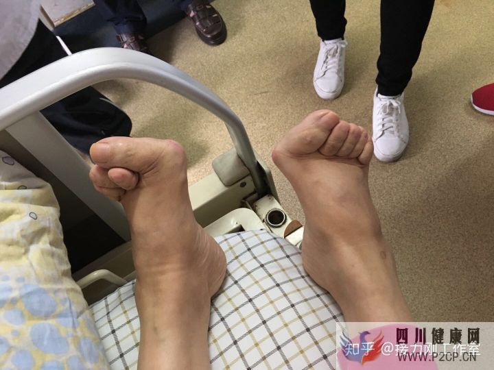 风湿病到底能不能治愈(图2) 风湿病到底能不能治愈(图2)