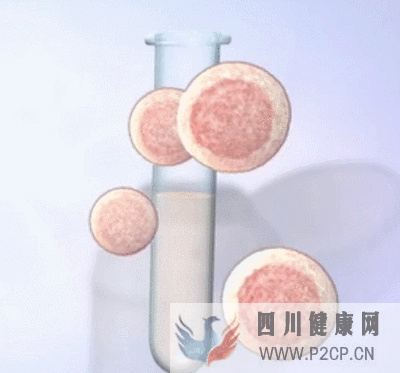 辅助生殖纳入医保啦(2022年试管婴儿费用医保可以报销吗)(图1) 辅助生殖纳入医保啦(2022年试管婴儿费用医保可以报销吗)(图1)