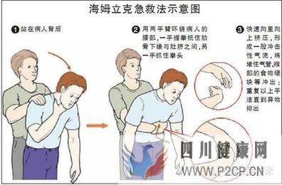 几种常见的急救方法(图3) 几种常见的急救方法(图3)