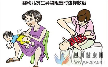 几种常见的急救方法(图7) 几种常见的急救方法(图7)
