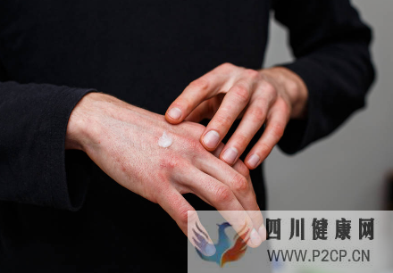 酒精过敏的症状有哪些?如何治疗酒精过敏?(图1) 酒精过敏的症状有哪些?如何治疗酒精过敏?(图1)