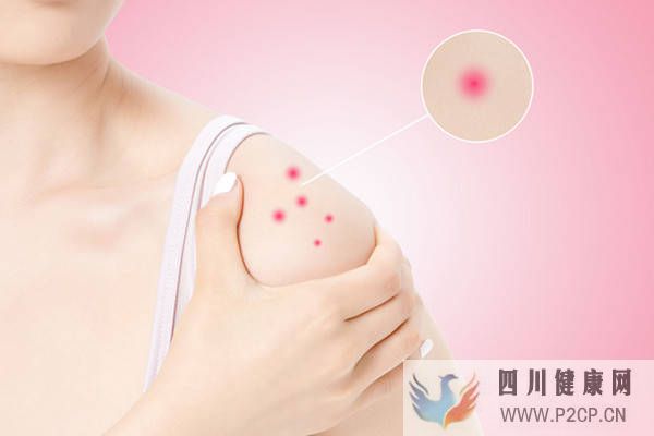 花生过敏同时会对什么过敏容易引起过敏的食物(图2)