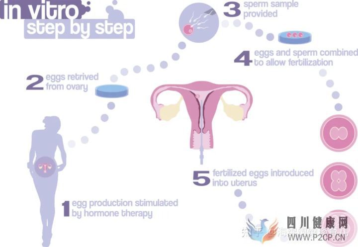 试管婴儿1代、2代、3代、4代哪个最好真实操作过...(第二代试管婴儿成功率有多少)(图4)