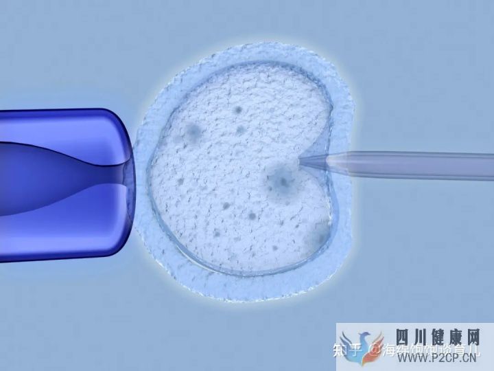 试管婴儿1代、2代、3代、4代哪个最好真实操作过...(第二代试管婴儿成功率有多少)(图11)