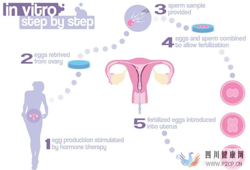 试管婴儿全过程是怎样的？什么是试管婴儿？(第二代试管婴儿怎么做的全过程)(图2)