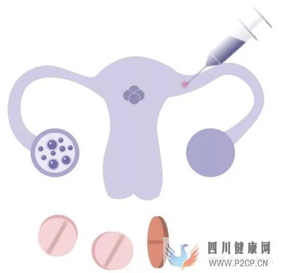干货女性取卵全过程(两个女生试管婴儿怎么做的全过程)(图2) 干货女性取卵全过程(两个女生试管婴儿怎么做的全过程)(图2)