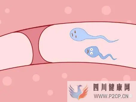 输卵管不孕做试管婴儿手术过程中,常见的六个问题(女方输卵管堵塞做试管婴儿需要多长时间)(图1)