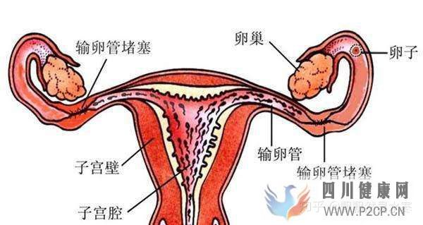 输卵管堵塞可以做试管婴儿吗什么时候检查(女方输卵管堵塞做试管婴儿需要多长时间)(图1)