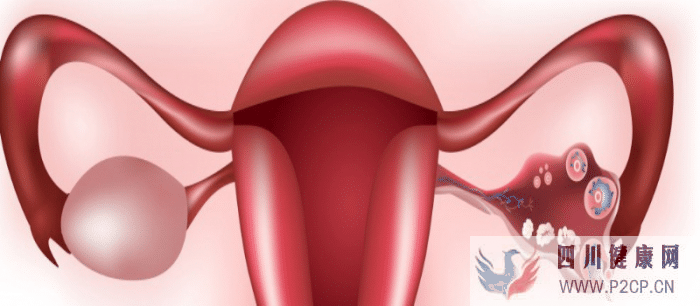 输卵管堵塞可以做试管婴儿吗(女方输卵管堵塞做试管婴儿需要多长时间)(图2)