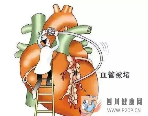 健身的十大好处,你全都知道吗(图12) 健身的十大好处,你全都知道吗(图12)