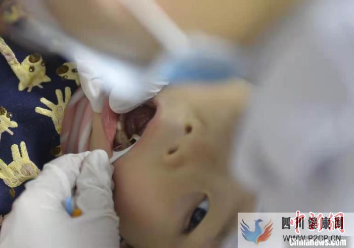 世界口腔健康日：口腔护理从宝宝开始(图3)