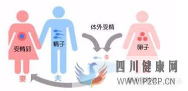 最全面详解试管婴儿具体流程(试管婴儿步骤过程详细百度)(图2) 最全面详解试管婴儿具体流程(试管婴儿步骤过程详细百度)(图2)