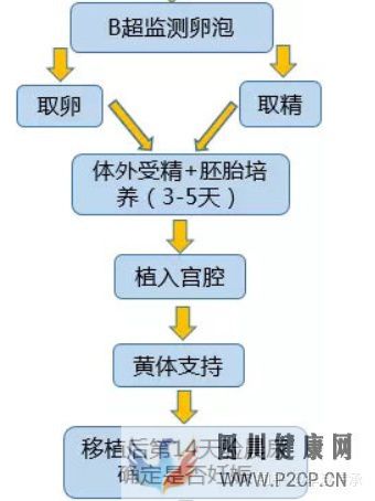 最全面详解试管婴儿具体流程(试管婴儿步骤过程详细百度)(图3)