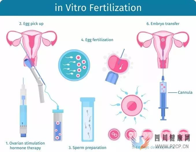 做试管婴儿一个周期大概需要多久(试管婴儿步骤过程详细大概多久)(图1)