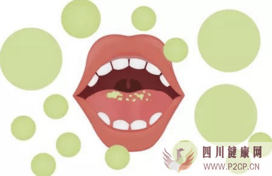 口腔健康：口腔益生菌的作用及口腔益生菌为何能有效去除口腔异味(图1)