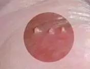 男科常见的几种检查项目,绝对认真!!!(图9) 男科常见的几种检查项目,绝对认真!!!(图9)