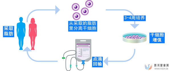 肝硬化、脂肪肝、肝功能不全等肝脏疾病的治疗日本干细胞效果如何(干细胞的效果)(图4)
