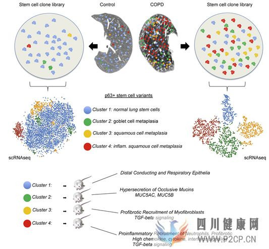Cell：重磅！作为全球主要死亡原因的慢性阻塞性肺病竟是一种肺干细胞病(干细胞的主要功效)(图1)