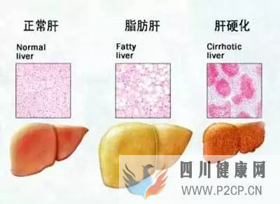 肝硬化的干细胞疗法作用原理(干细胞的作用和价格表)(图3)