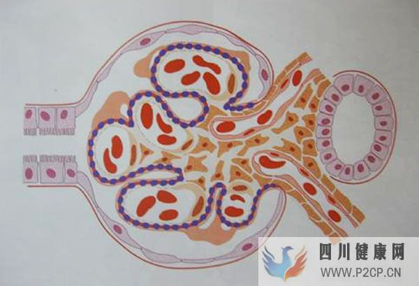 男子膜性肾病尿常白反复,用中药后保持稳定,中医如何治疗膜肾?(图1) 男子膜性肾病尿常白反复,用中药后保持稳定,中医如何治疗膜肾?(图1)