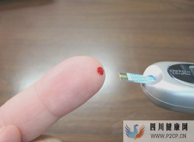 糖尿病酮症酸中毒有哪些症状?糖尿病酮症酸中毒如何处理?(图1) 糖尿病酮症酸中毒有哪些症状?糖尿病酮症酸中毒如何处理?(图1)
