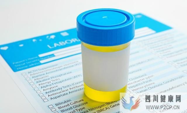 IgA肾病怎么治?来看医生讲解IgA肾病的治疗原则(图1) IgA肾病怎么治?来看医生讲解IgA肾病的治疗原则(图1)