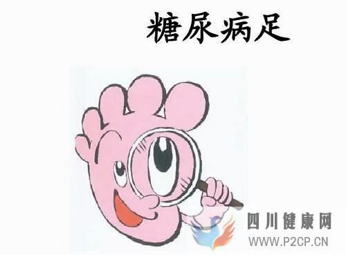 糖尿病足合并有肾病该怎么去治疗?(图1) 糖尿病足合并有肾病该怎么去治疗?(图1)