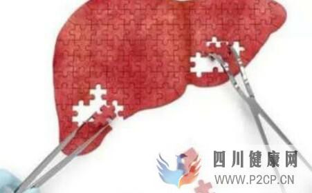 引起肝硬化的原因是什么(图1) 引起肝硬化的原因是什么(图1)