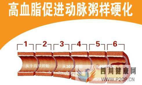 糖尿病血脂异常的5大症状表现!(图1) 糖尿病血脂异常的5大症状表现!(图1)