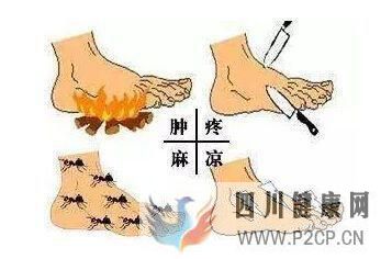 糖尿病下肢血管病变以后会出现什么症状?(图1) 糖尿病下肢血管病变以后会出现什么症状?(图1)
