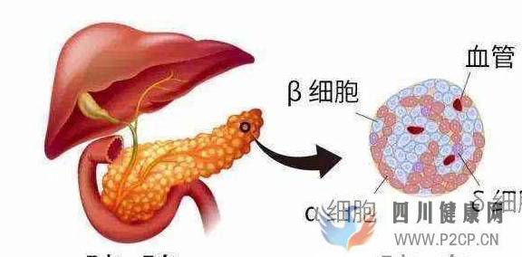 糖尿病是吃糖吃出来的？得了糖尿病还能吃糖吗？很多朋友没搞清楚(图1)