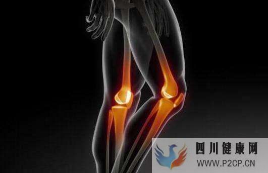 膝关节骨性关节炎的症状有哪些_怎么治疗比较好_健康百科(图1)