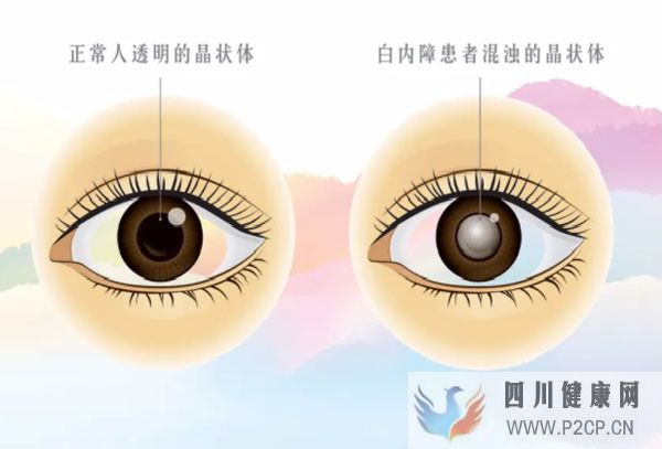 男子眼睛视力下降查出糖尿病，高血糖为何会伤眼？中医辨证疗法(图3)