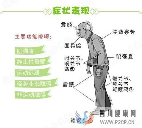 什么是震颤麻痹,震颤麻痹都有哪些症状,怎么样治疗?(图1) 什么是震颤麻痹,震颤麻痹都有哪些症状,怎么样治疗?(图1)