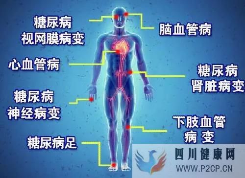 糖尿病患者容易出现哪些并发症(图1) 糖尿病患者容易出现哪些并发症(图1)