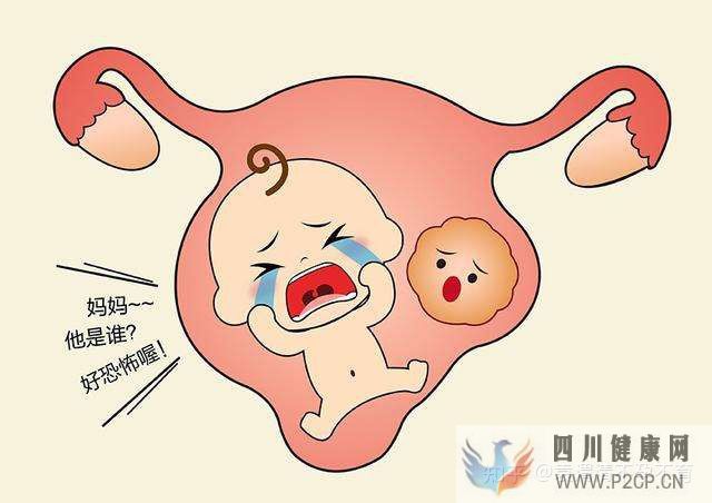 习惯性流产怎么办(图6) 习惯性流产怎么办(图6)