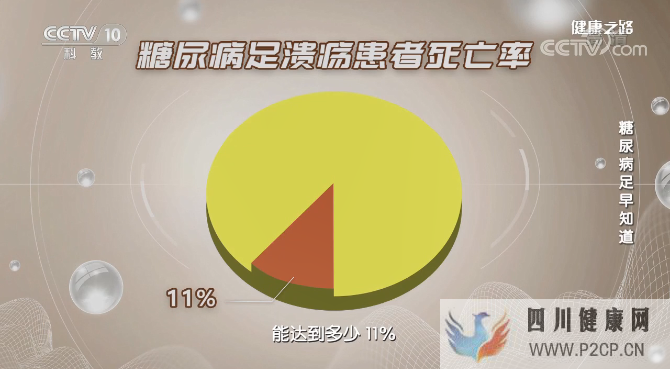最新研究!干细胞疗法有望使糖尿病相关截肢成为过去(图1) 最新研究!干细胞疗法有望使糖尿病相关截肢成为过去(图1)