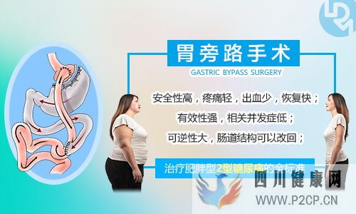 糖尿病怎么治疗做胃旁路手术会影响寿命吗?(图1) 糖尿病怎么治疗做胃旁路手术会影响寿命吗?(图1)
