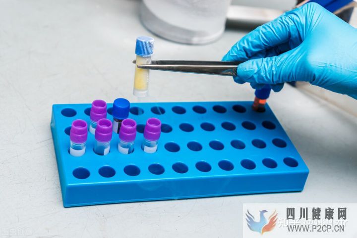 解密黑科技干细胞到底能不能打干细胞的副作用和...(图15)