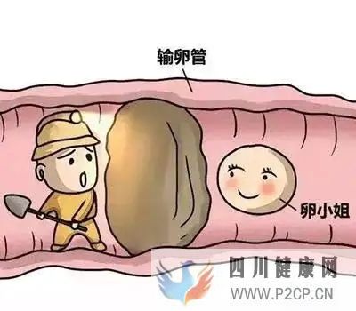 输卵管堵塞自己会有感觉吗(图1) 输卵管堵塞自己会有感觉吗(图1)