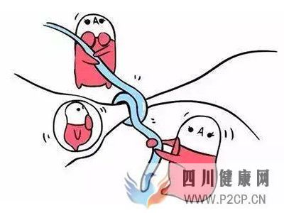 输卵管堵塞患者的注意事项(图1) 输卵管堵塞患者的注意事项(图1)