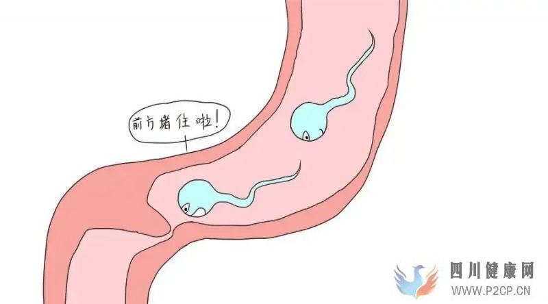 输卵管堵塞会有哪些症状(图1)