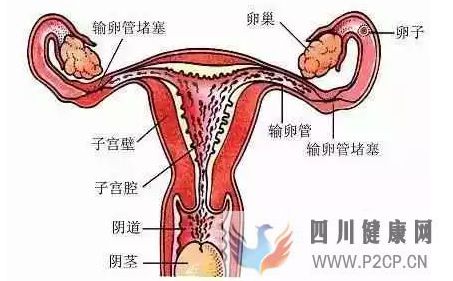 不孕不育_输卵管不孕,女性不孕的最大危害之一!_知乎_(图1)