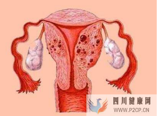 身有HPV不要大意，打一针加一个营养方可赶跑它，宫颈癌绕着走(图1)