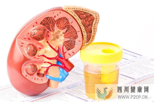 男子肾病尿蛋白3+,用中药益气补肾降蛋白,中医如何控制病情?(图1) 男子肾病尿蛋白3+,用中药益气补肾降蛋白,中医如何控制病情?(图1)