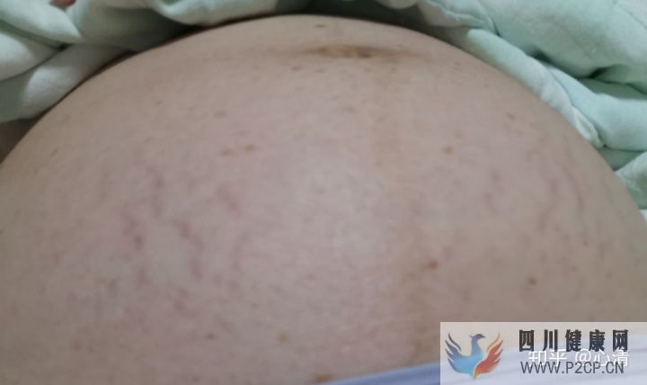 产科通关路怀孕、建档、产检、分娩全记录(完结)(图8) 产科通关路怀孕、建档、产检、分娩全记录(完结)(图8)