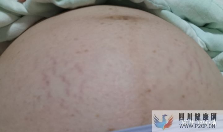 产科通关路怀孕、建档、产检、分娩全记录(完结)(图9) 产科通关路怀孕、建档、产检、分娩全记录(完结)(图9)