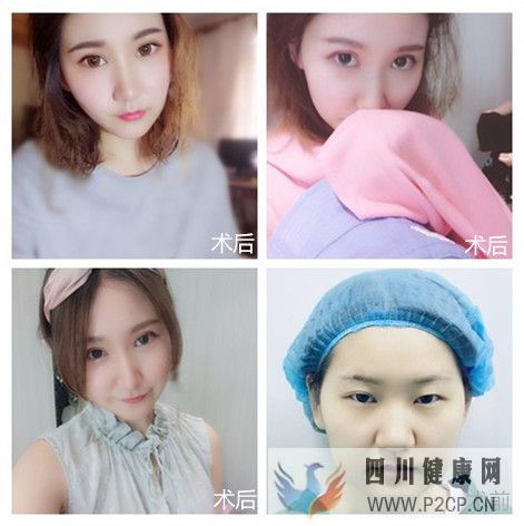 美容整形前一定要知道的美容整形知识(图1) 美容整形前一定要知道的美容整形知识(图1)